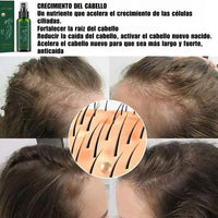 Sérum Capilar Fortificante - HairBoost Pro™ 🌿💆♀️