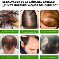 Sérum Capilar Fortificante - HairBoost Pro™ 🌿💆♀️