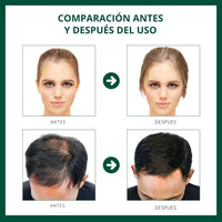 Sérum Capilar Fortificante - HairBoost Pro™ 🌿💆♀️