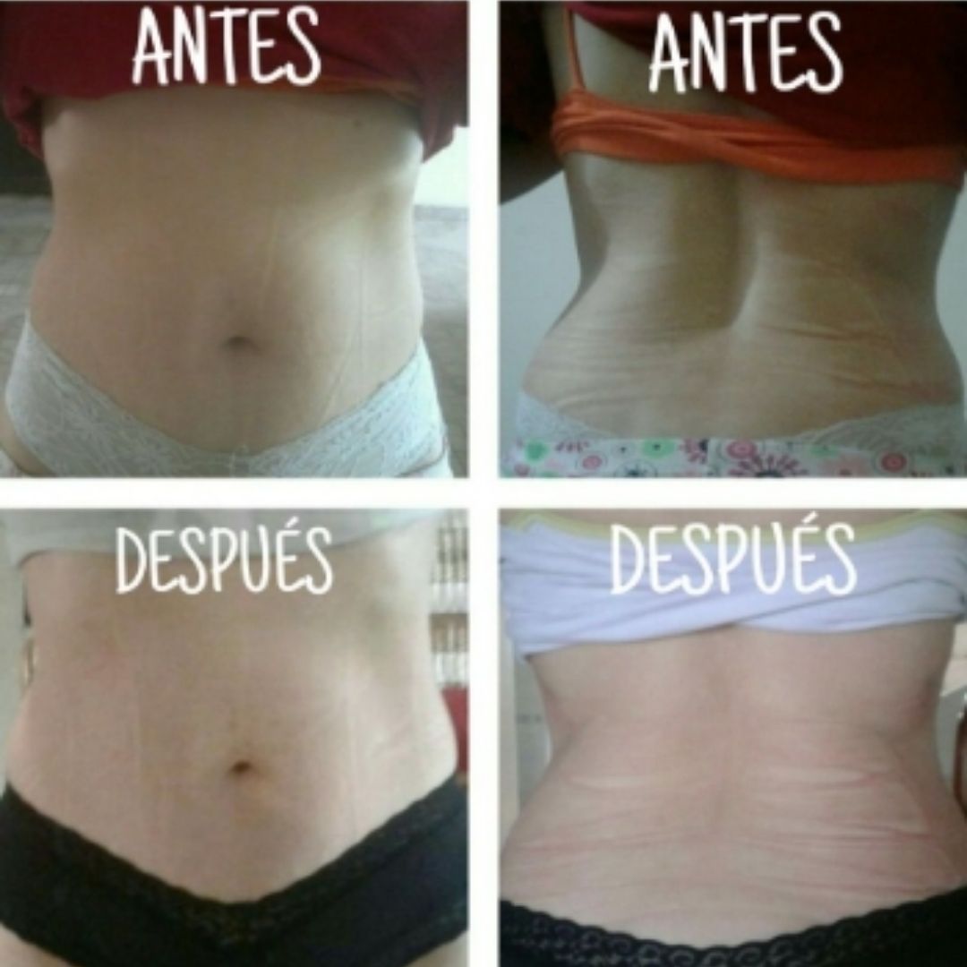📏🔥 Faja Reductora con Yeso Termoactivo - SculptFit Pro™ 💪✨