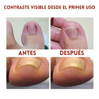 German ToenailPlus – Uñas Fuertes y Saludables en Casa! 💅🦶