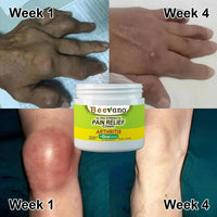 🐝 Beevana™ Crema Terapéutica para Articulaciones y Huesos 🦴