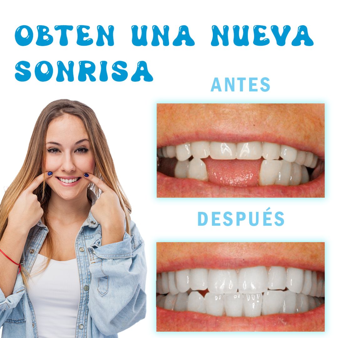 Kit Temporal de Reparación Dental - DentaFix Pro™ 🦷✨