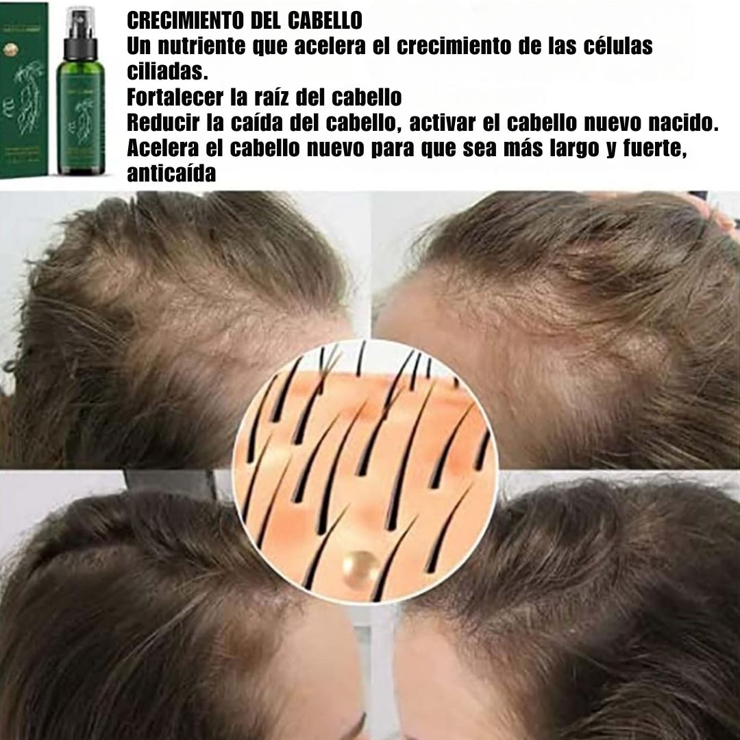 Sérum Capilar Fortificante - HairBoost Pro™ 🌿💆‍♀️