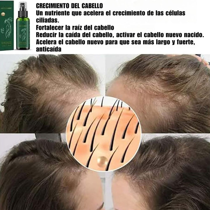 Sérum Capilar Fortificante - HairBoost Pro™ 🌿💆‍♀️