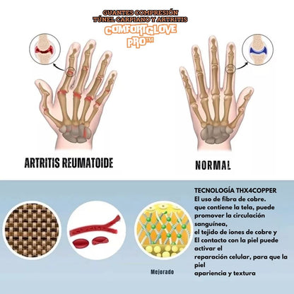 Guantes Compresión Túnel Carpiano y Artritis - ComfortGlove Pro™ 🖐️💪
