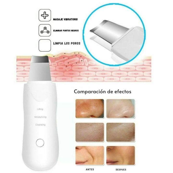 LimpiaPore™ - Limpiador Ultrasónico Facial🌟✨