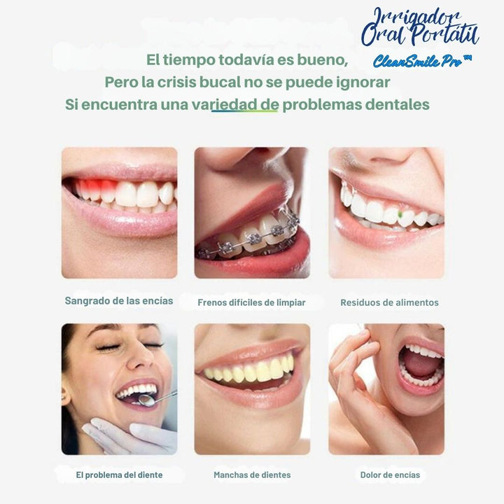 Irrigador Oral Portátil - CleanSmile Pro™ 💧🦷