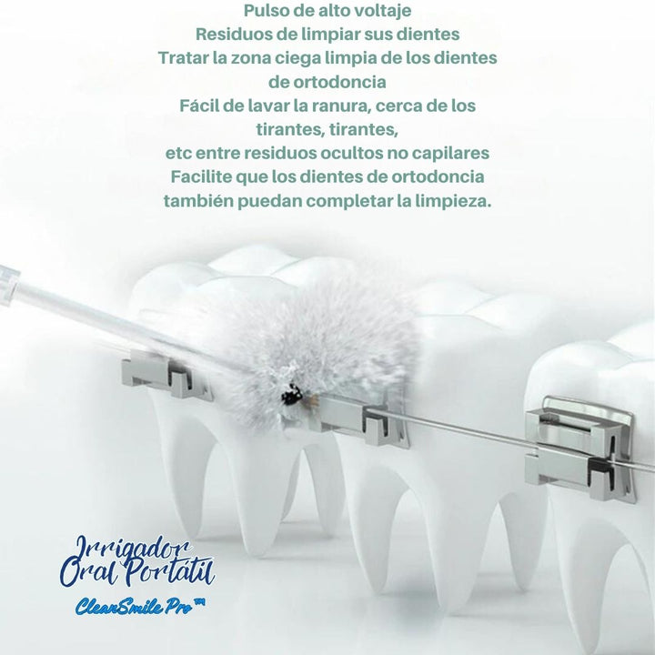 Irrigador Oral Portátil - CleanSmile Pro™ 💧🦷