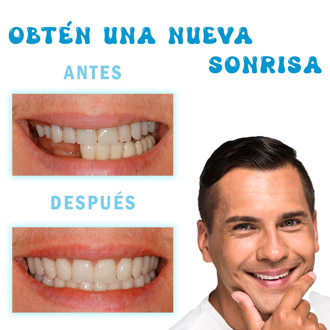 Kit Temporal de Reparación Dental - DentaFix Pro™ 🦷✨