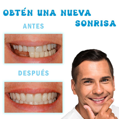 Kit Temporal de Reparación Dental - DentaFix Pro™ 🦷✨